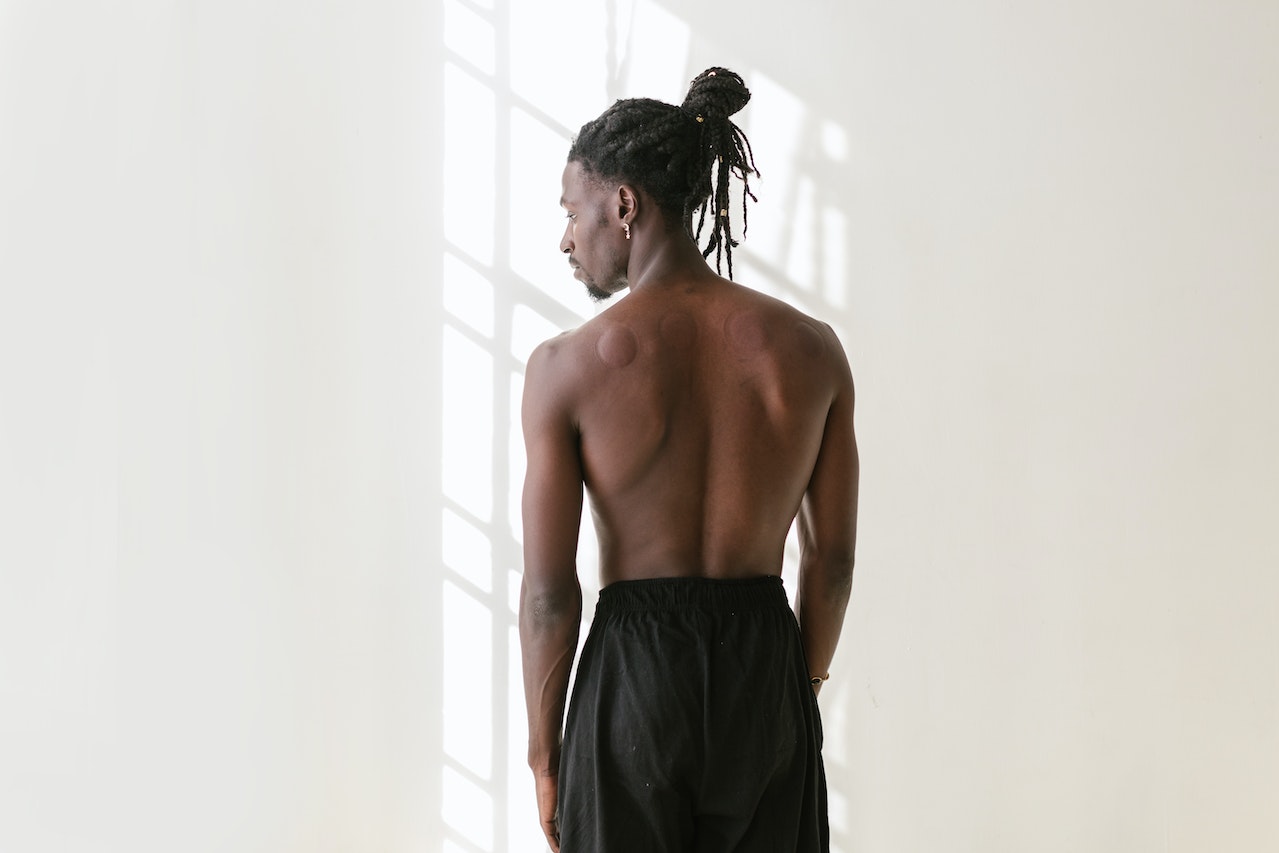 Dreadlock Itch: How to Soothe an Itchy Scalp after Working Out